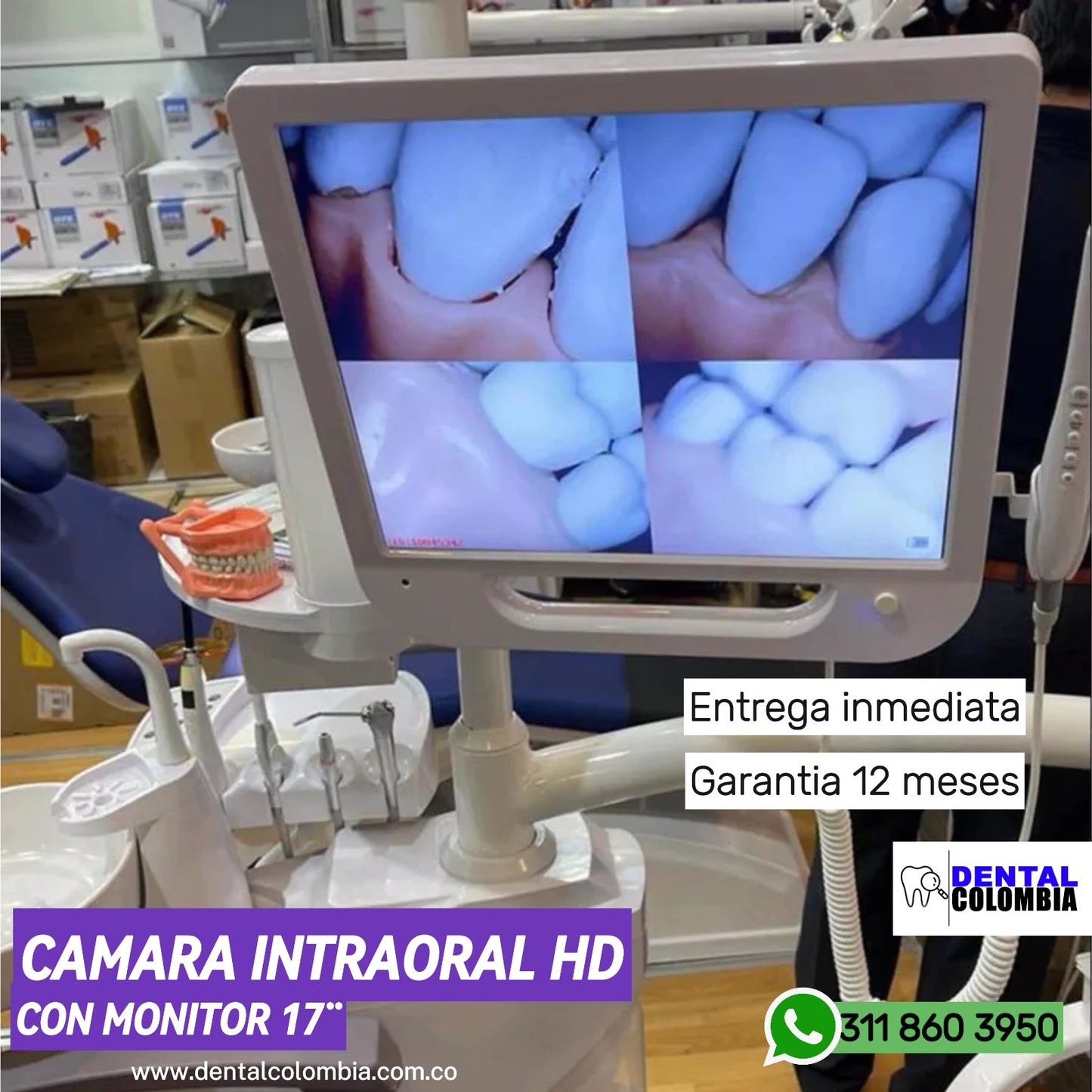 CAMARA INTRAORAL CON MONITOR - SISTEMA MULTIMEDIA 17¨