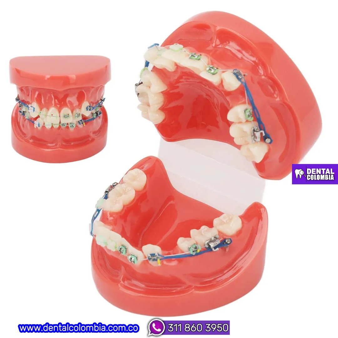 MODELO DE ORTODONCIA