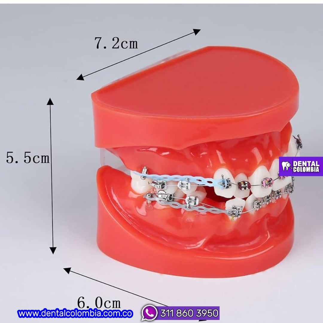 MODELO DE ORTODONCIA
