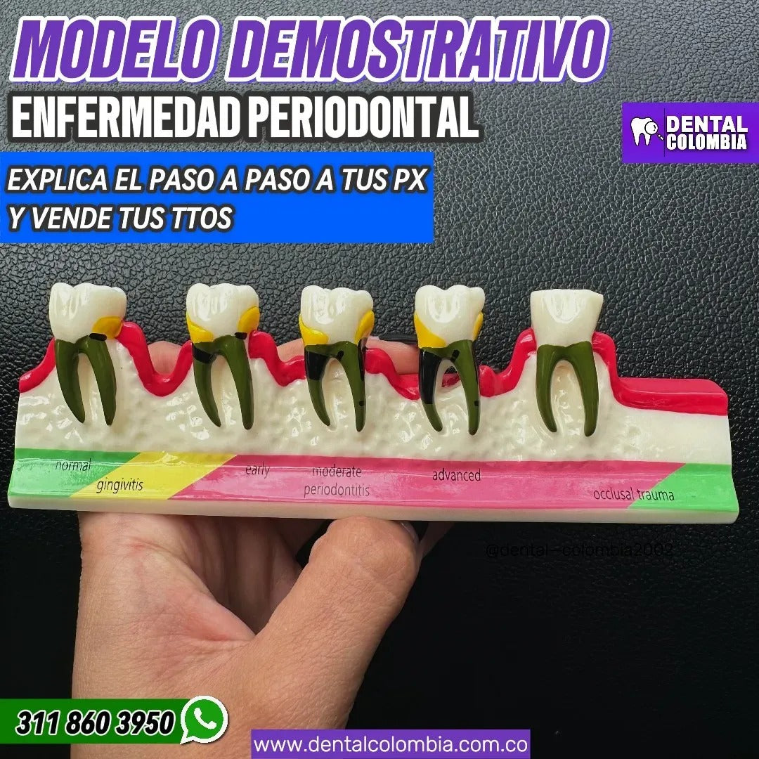 MODELO DE ENFERMEDAD PERIODONTAL