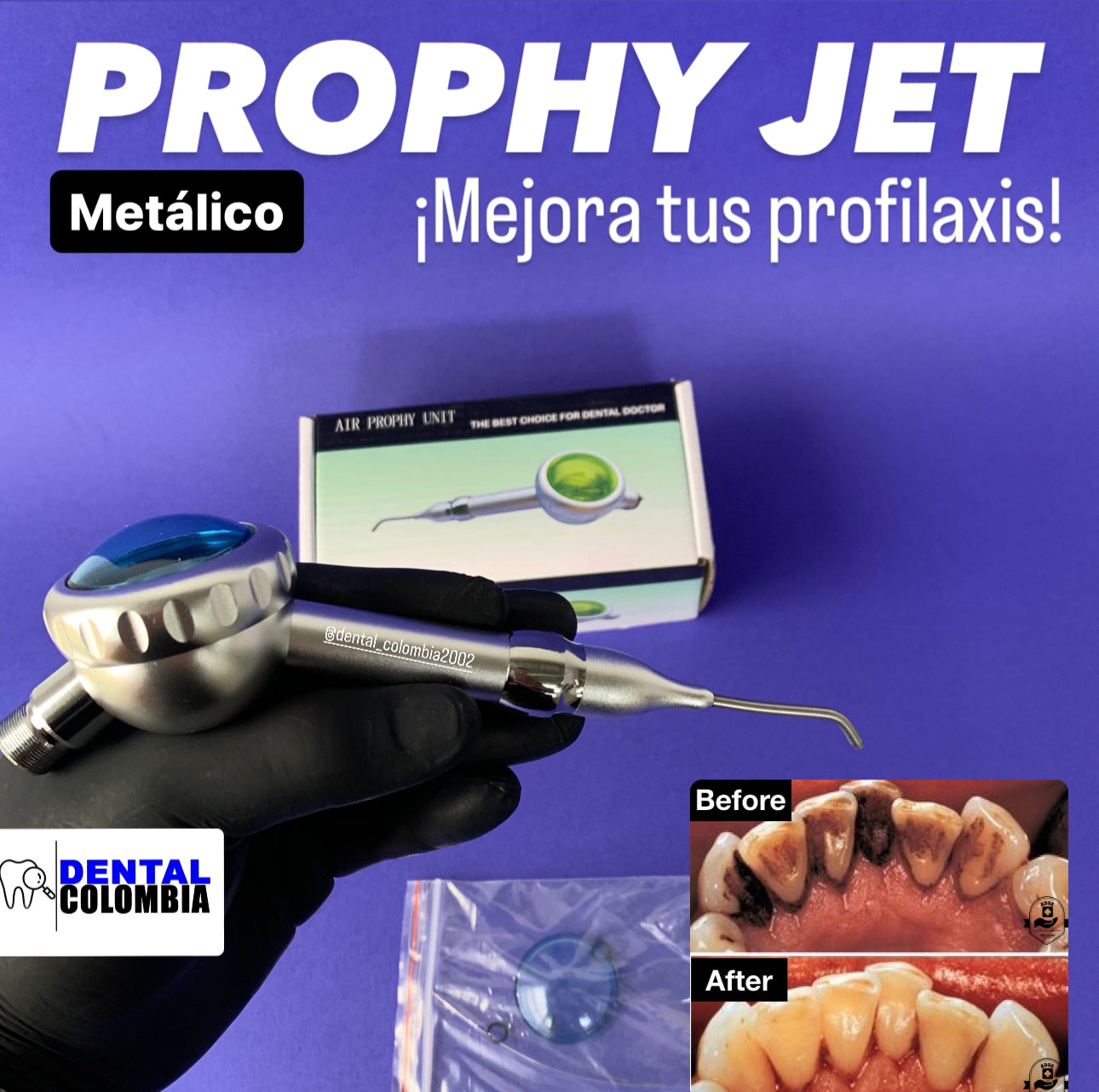 PROPHY JET METALICO