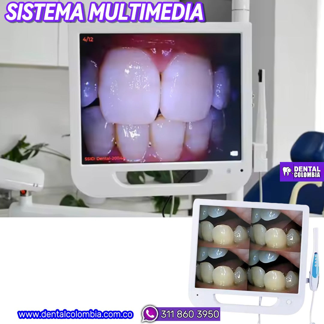 CAMARA INTRAORAL CON MONITOR - SISTEMA MULTIMEDIA 17¨